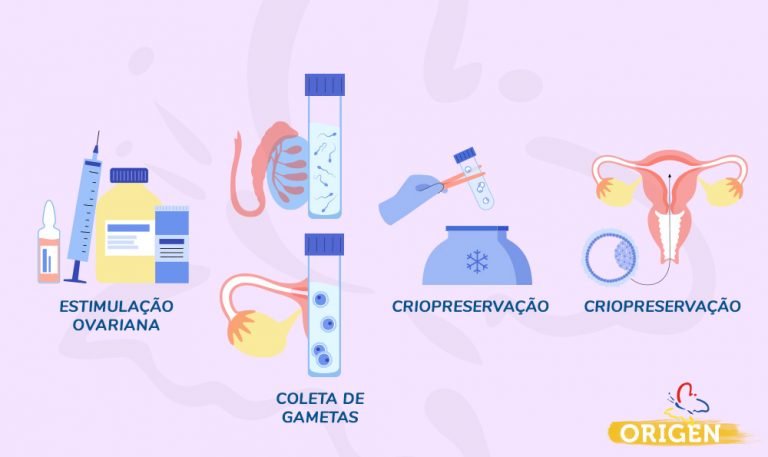 O que é preservação social da fertilidade Clínica Origen