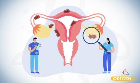 Endometriose Profunda Conhe A Os Sintomas Cl Nica Origen