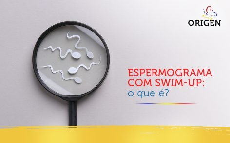 Espermograma Swim Up O Que Cl Nica Origen Fertiliza O In Vitro