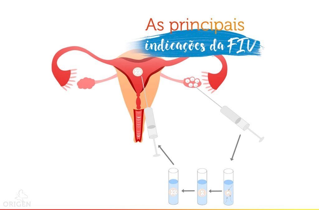 quais-as-principais-indicacoes-da-fertilizacao-in-vitro