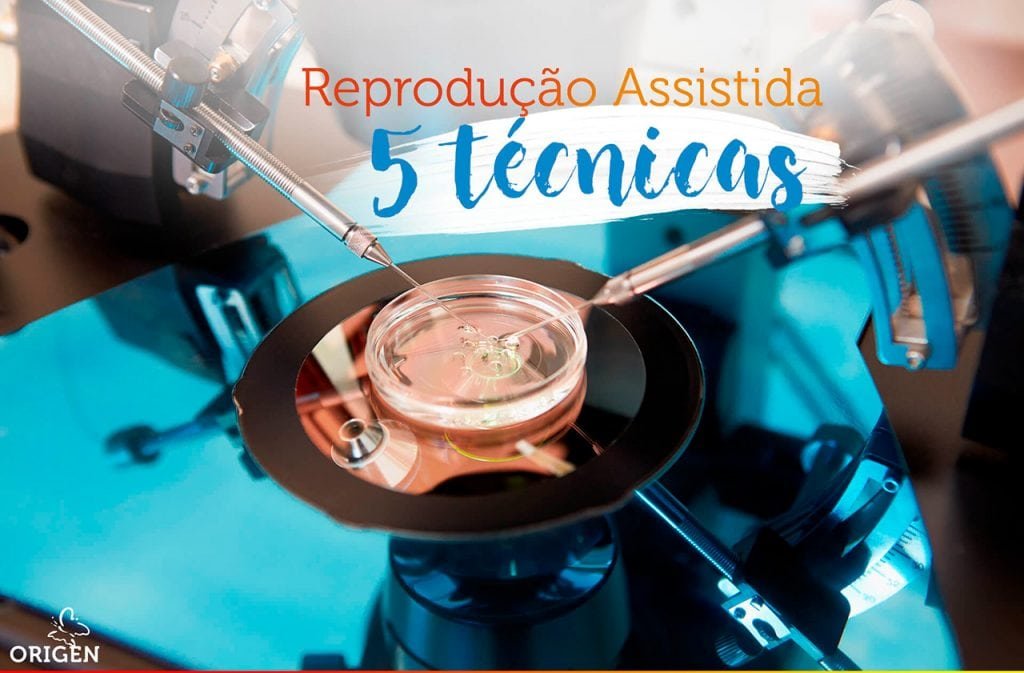 Reprodução Assistida Conheça As 5 Técnicas Mais Utilizadas Clínica Origen Fertilização In Vitro 