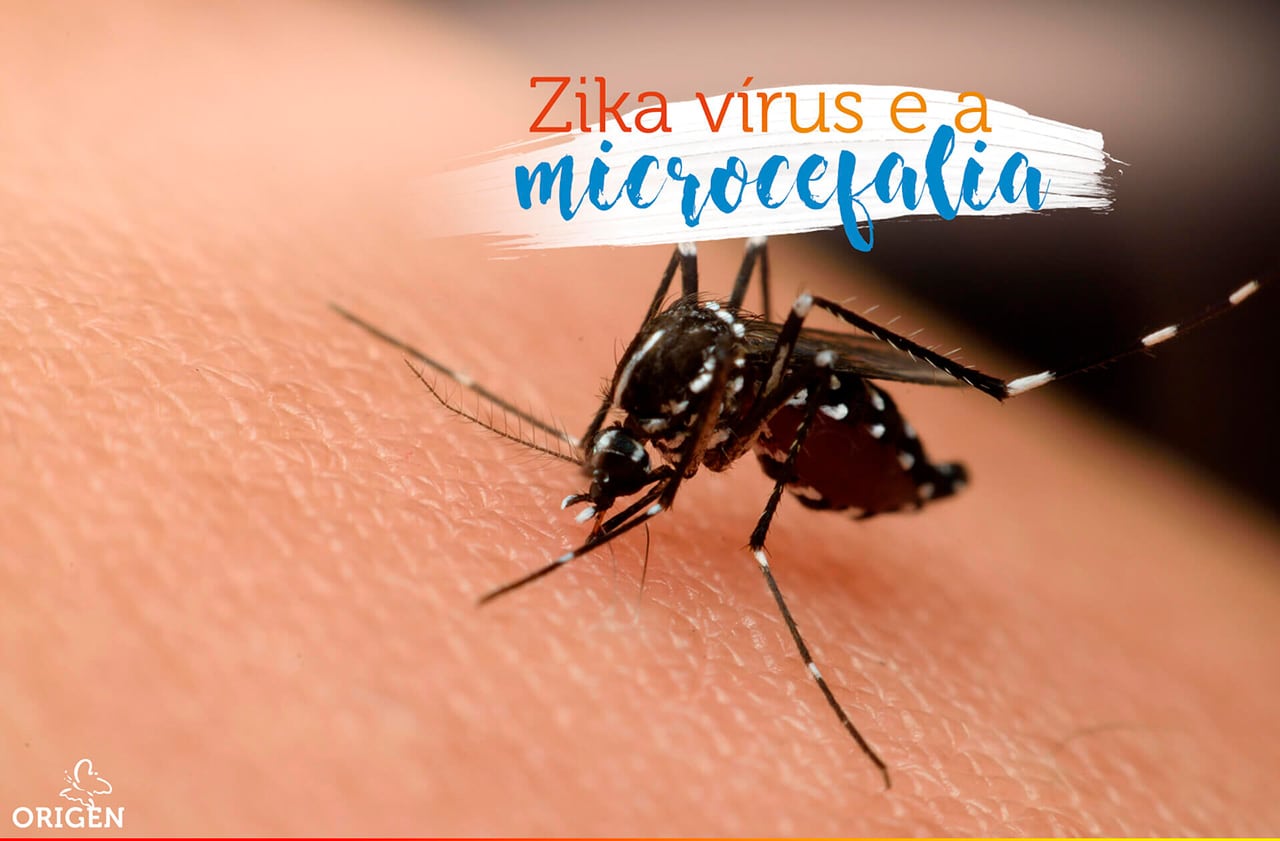 Zika vírus é causador de microcefalia