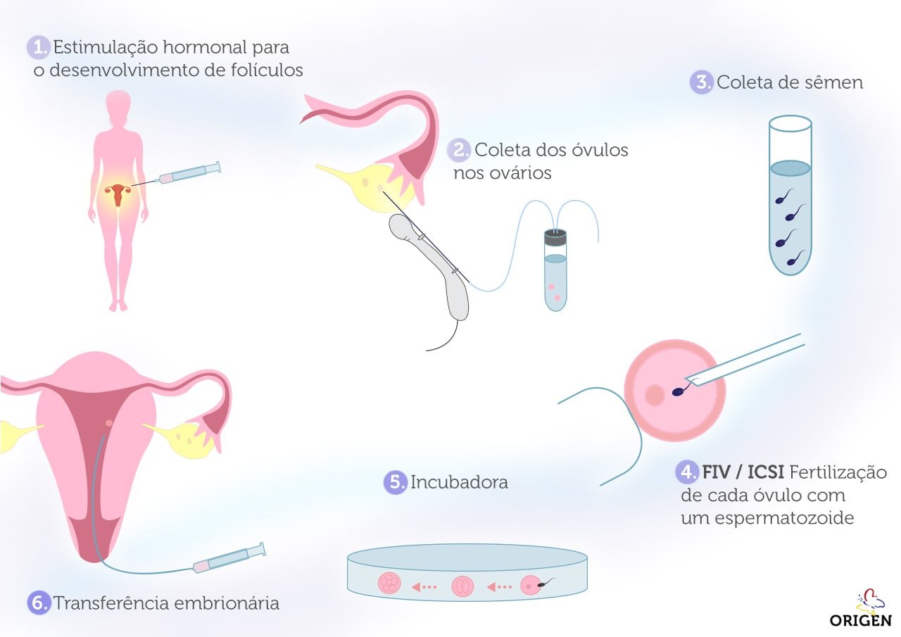 Infográfico Passo a Passo da FIV