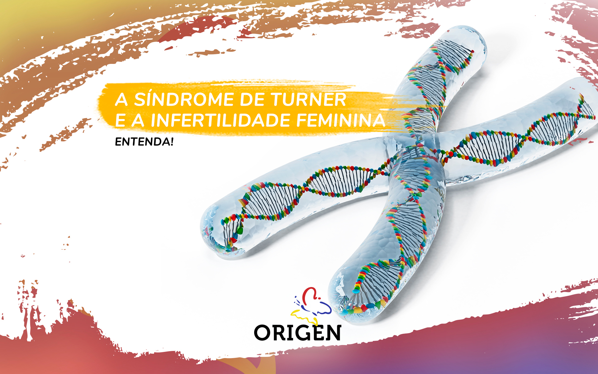 A síndrome de Turner e a infertilidade feminina. Entenda!