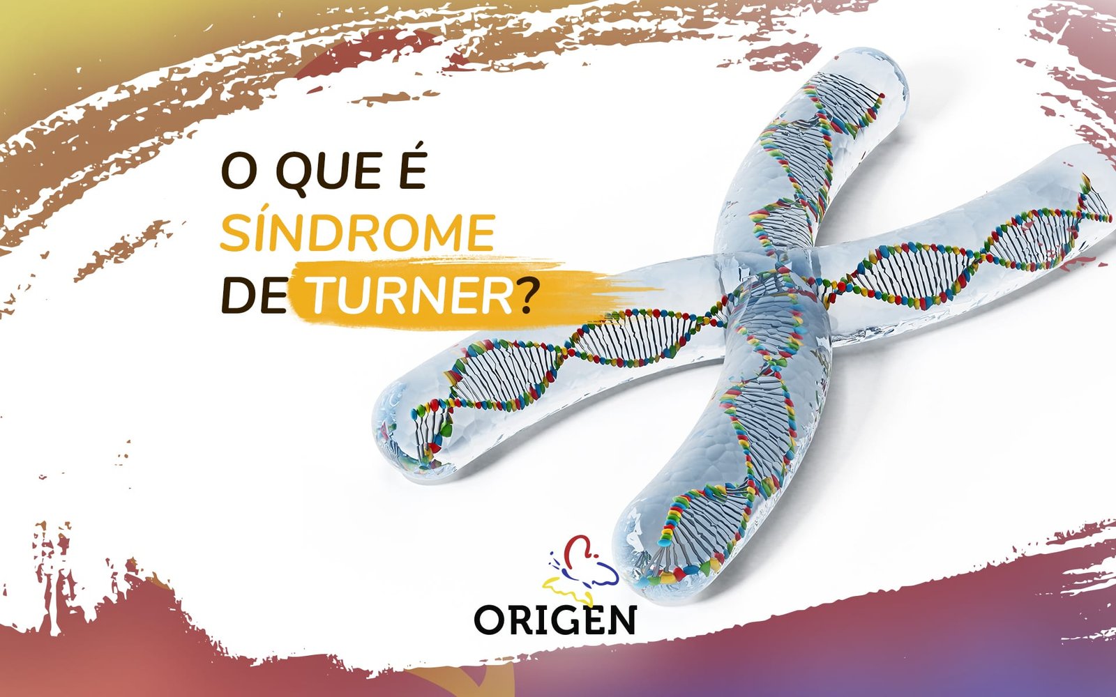 A síndrome de Turner e a infertilidade feminina. Entenda!