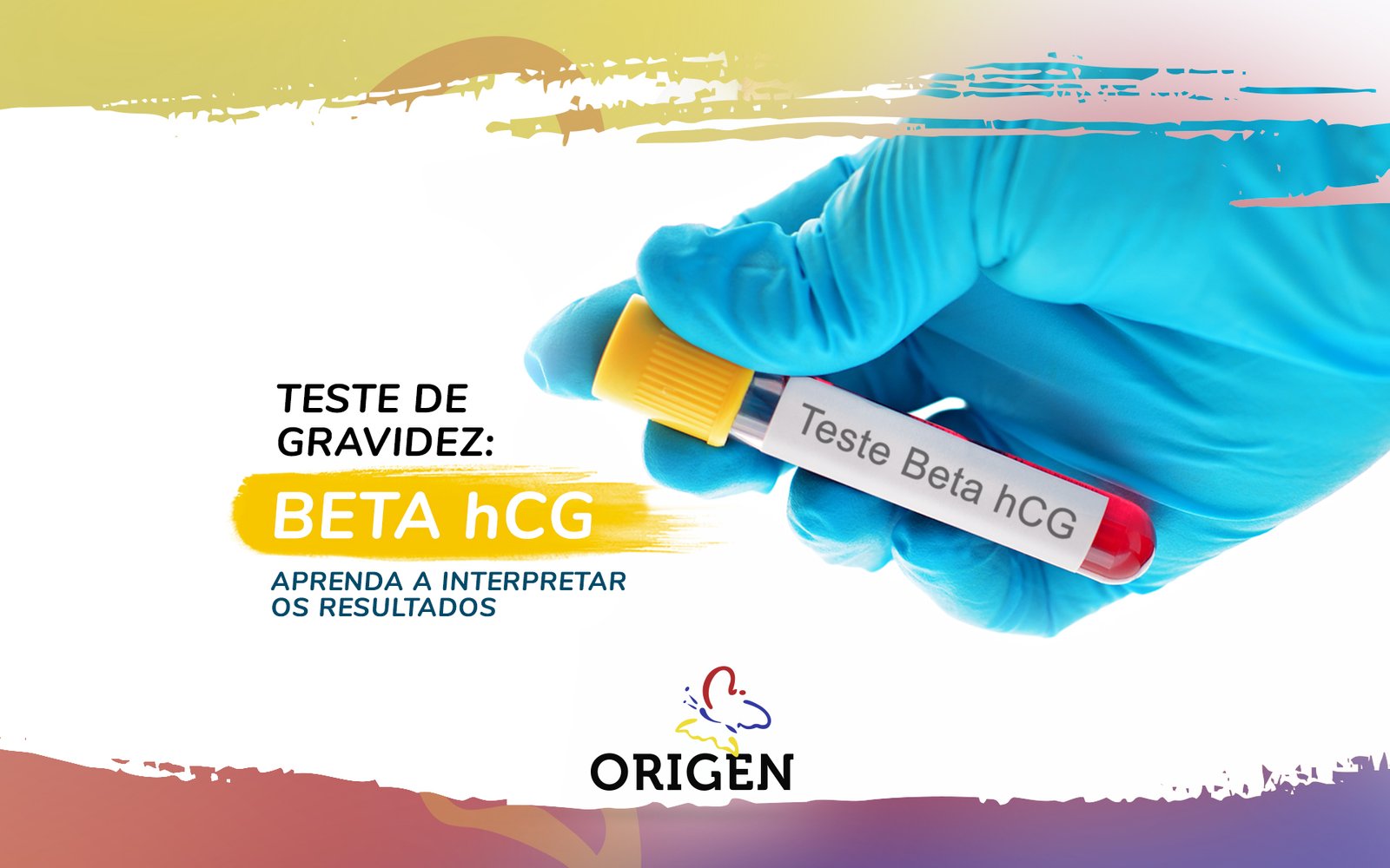 Teste de gravidez Beta hCG: aprenda a interpretar os resultados