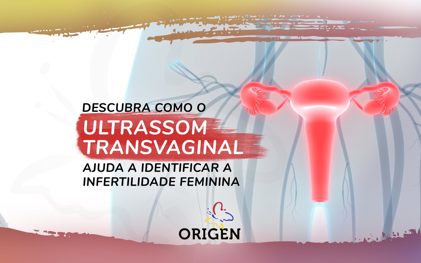 Ecografia transvaginal mostrando ovário de aspecto normal, com a