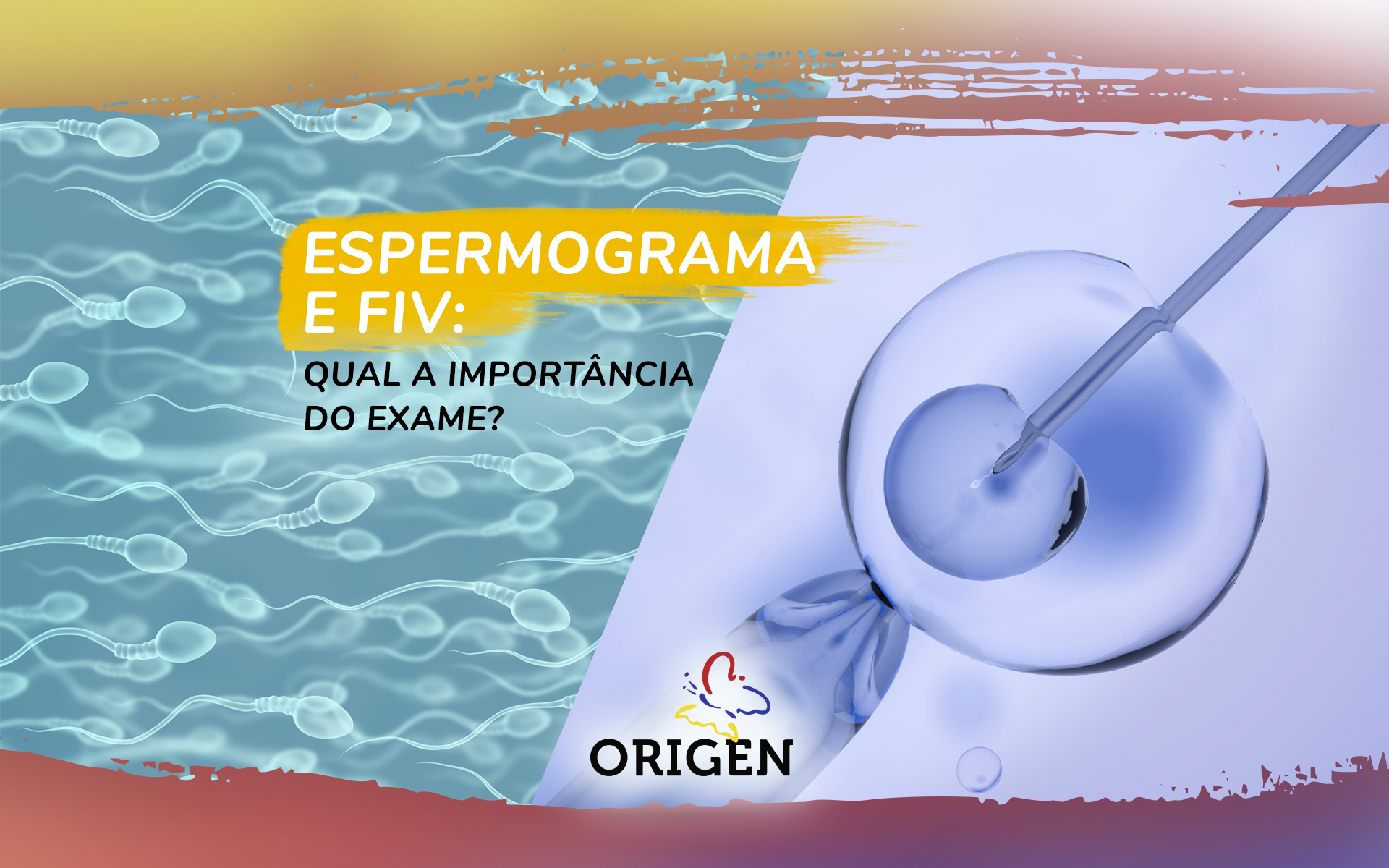 Espermograma e FIV: qual a importância do exame?