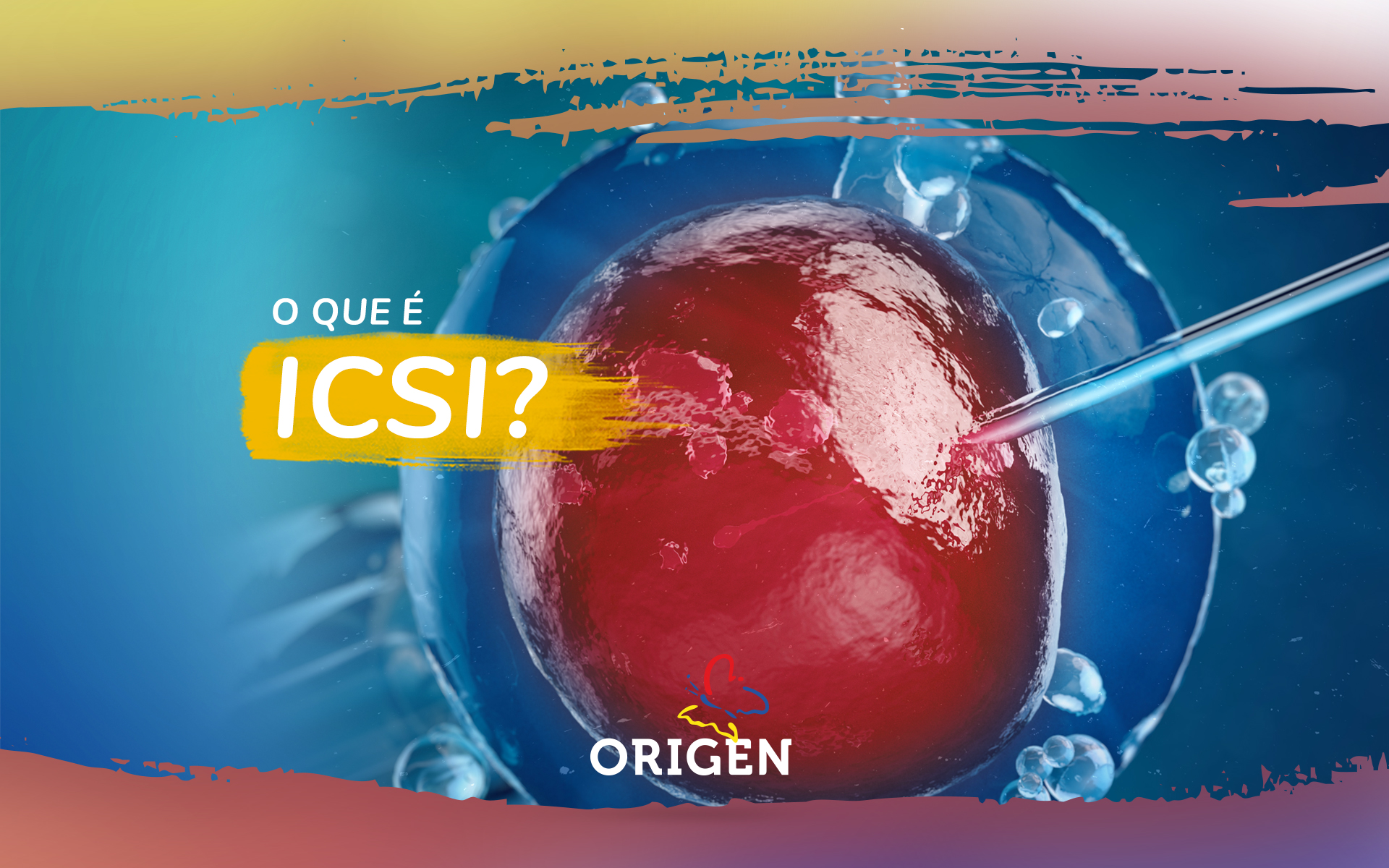 O que é ICSI?