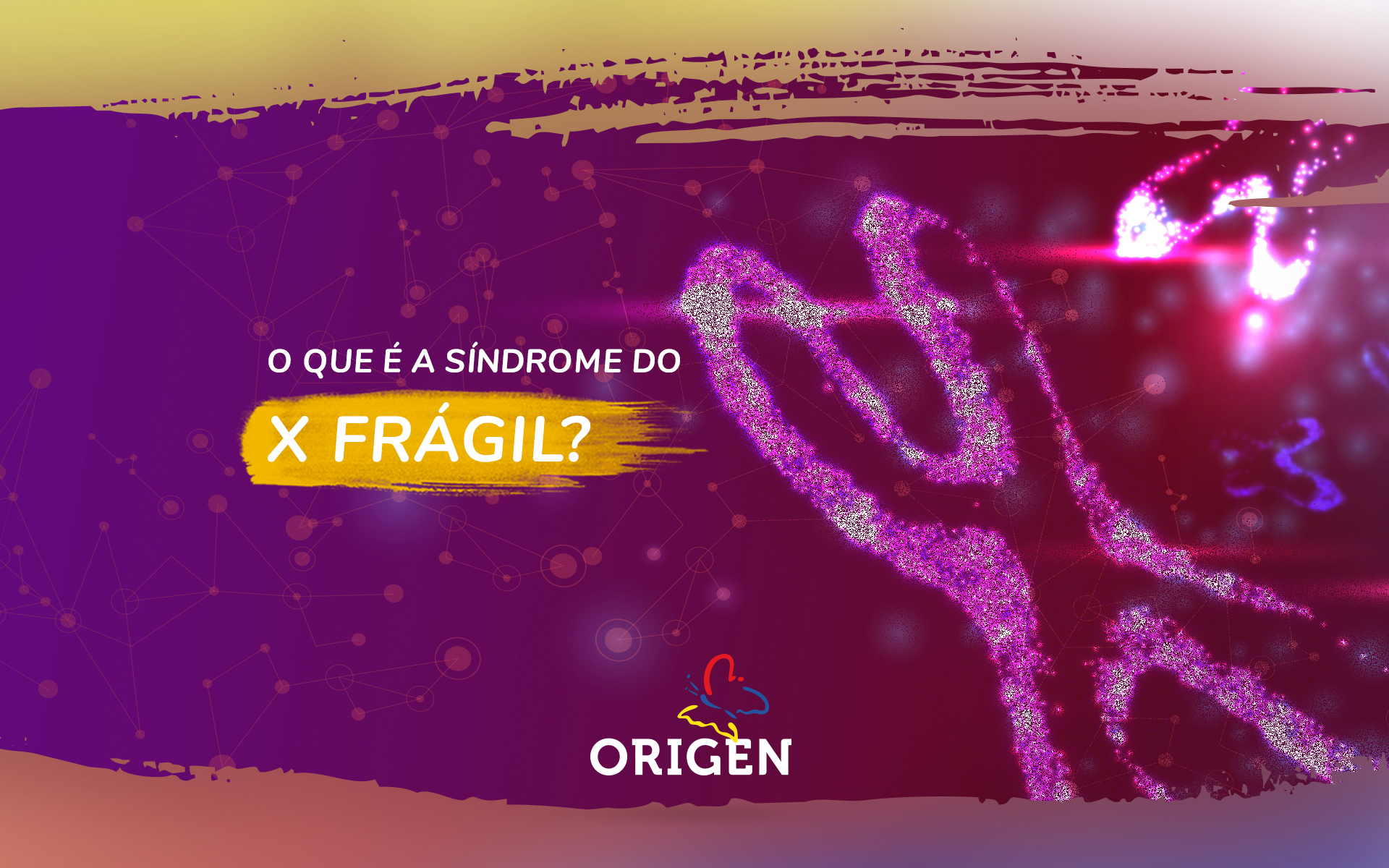 O que é a síndrome do X frágil?