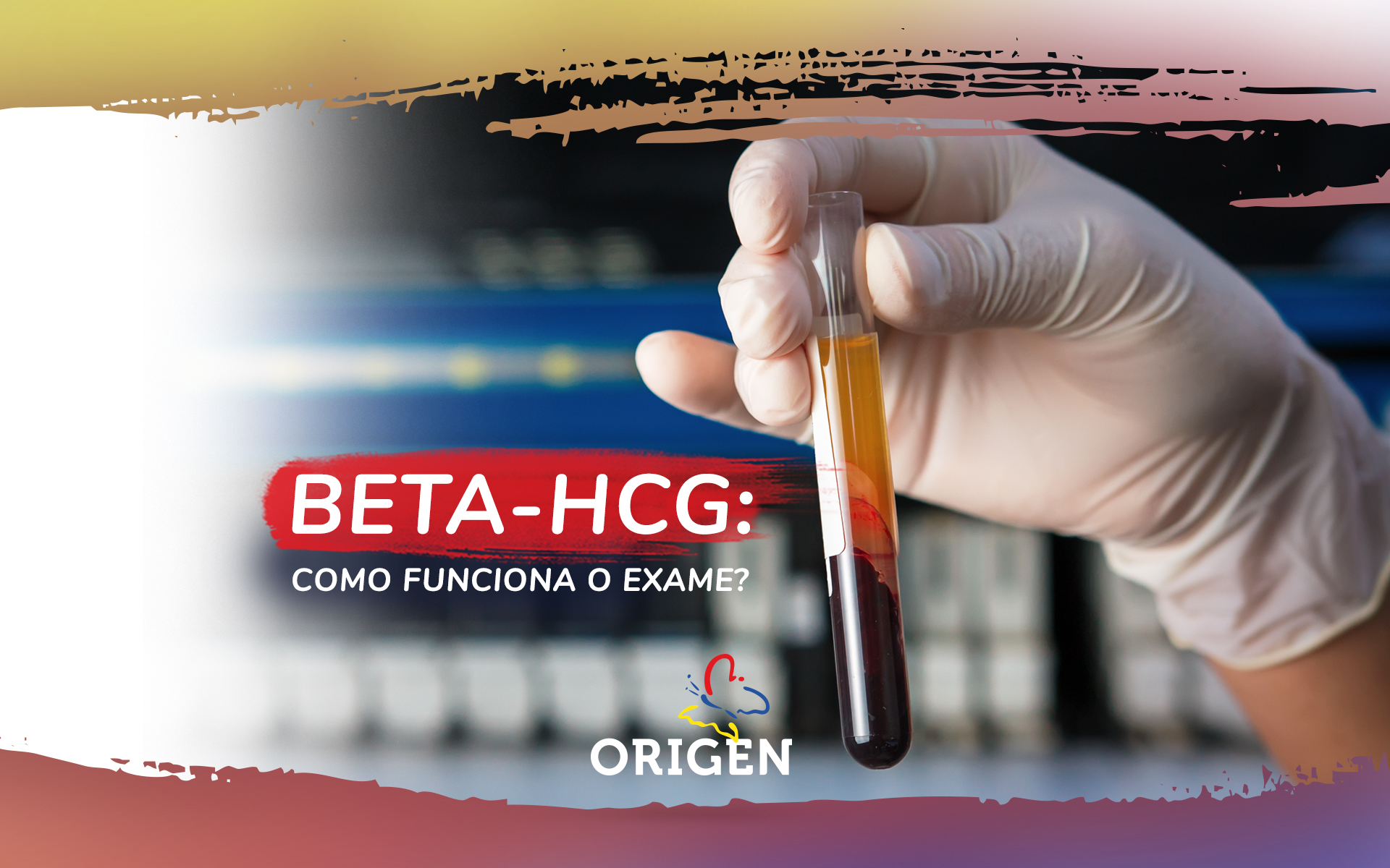Beta-hCG: como funciona o exame?