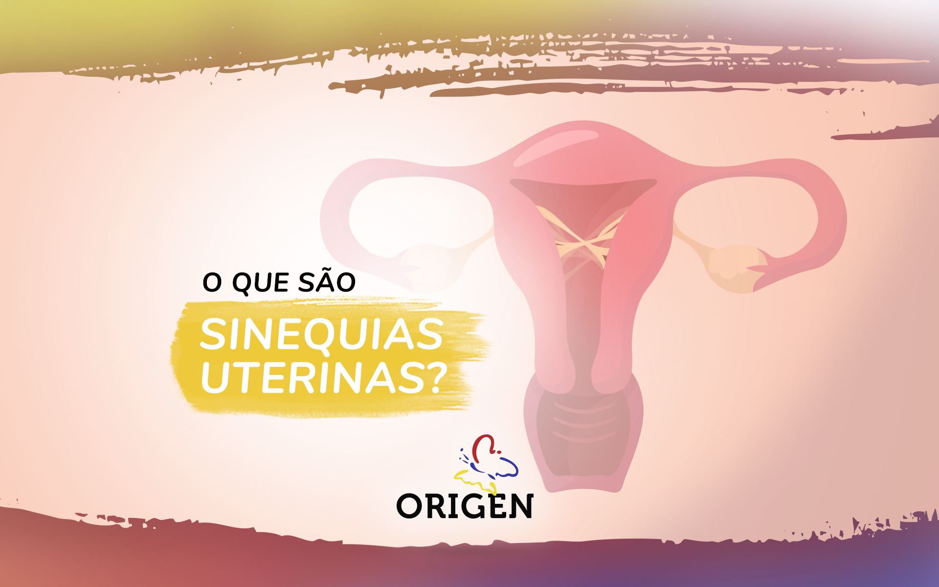 O que são sinequias uterinas?