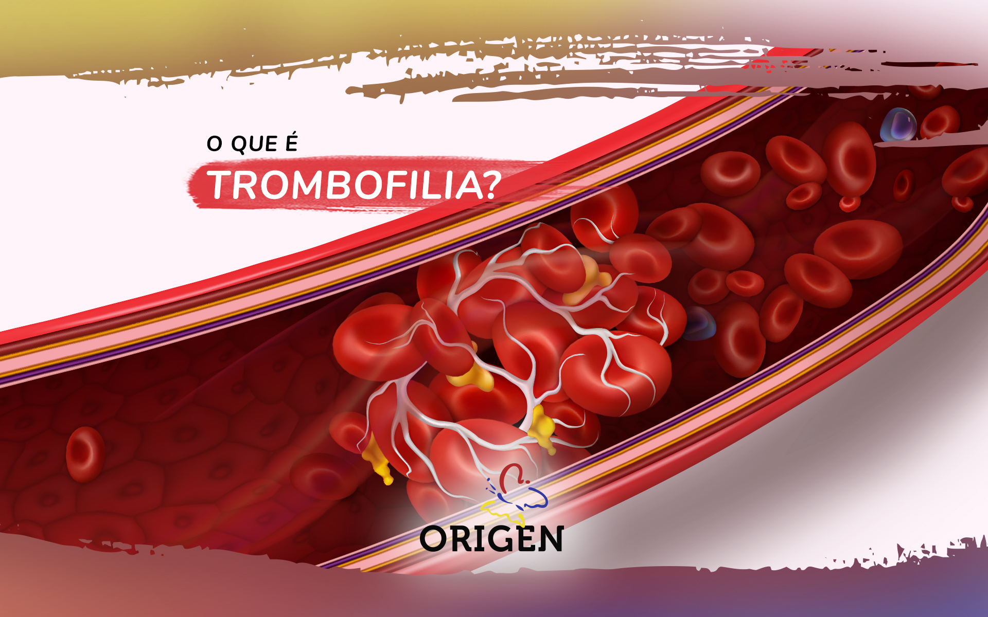 O que é trombofilia?