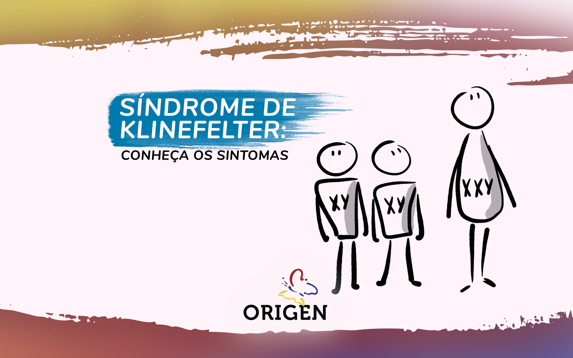Síndrome de Klinefelter: conheça os sintomas