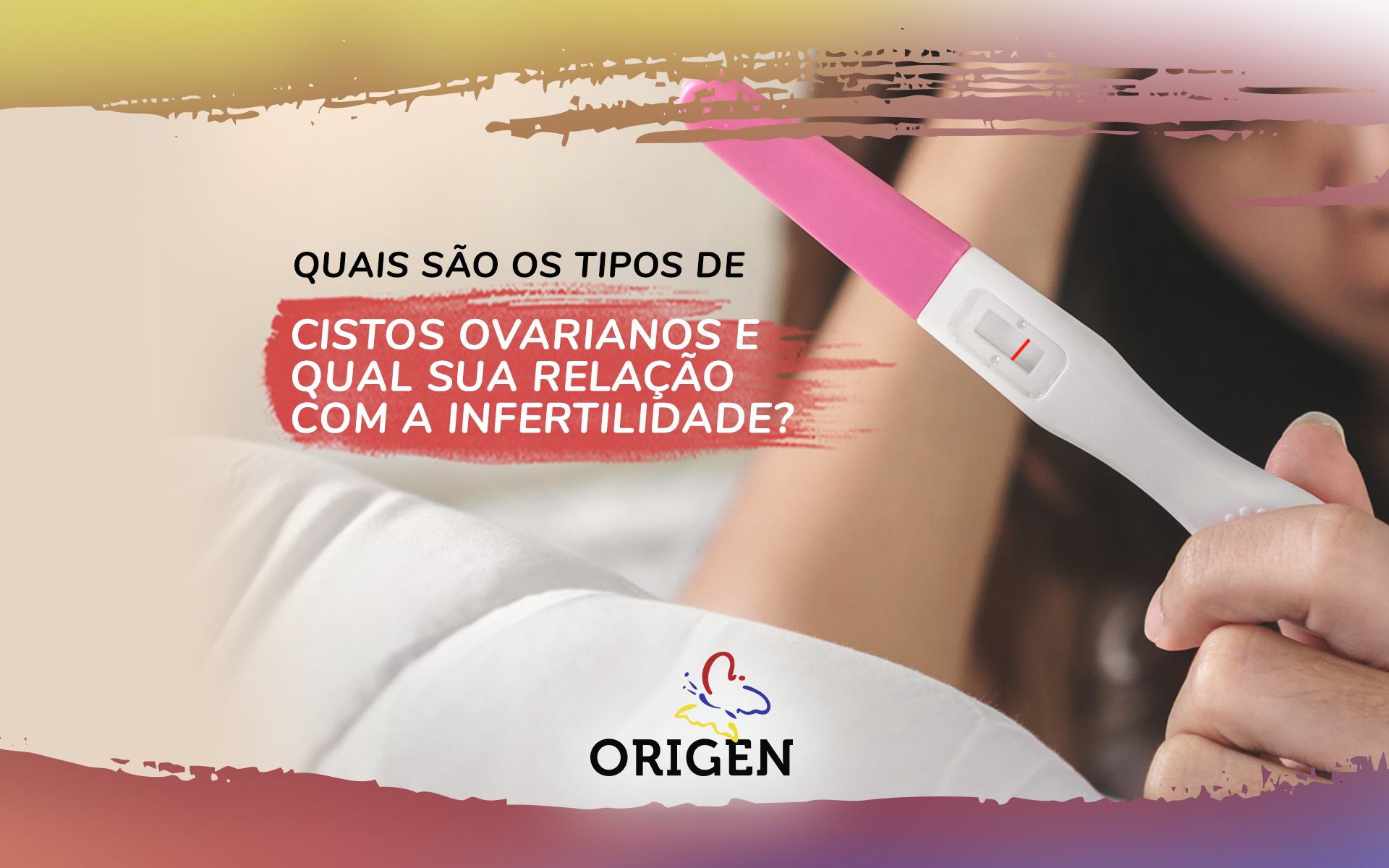 Quais são os tipos de cistos ovarianos e qual sua relação com a infertilidade?