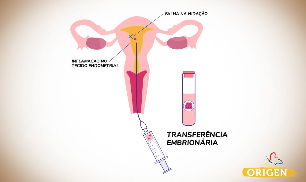 Endometrite: veja quais são os sintomas - Clínica Reproduce