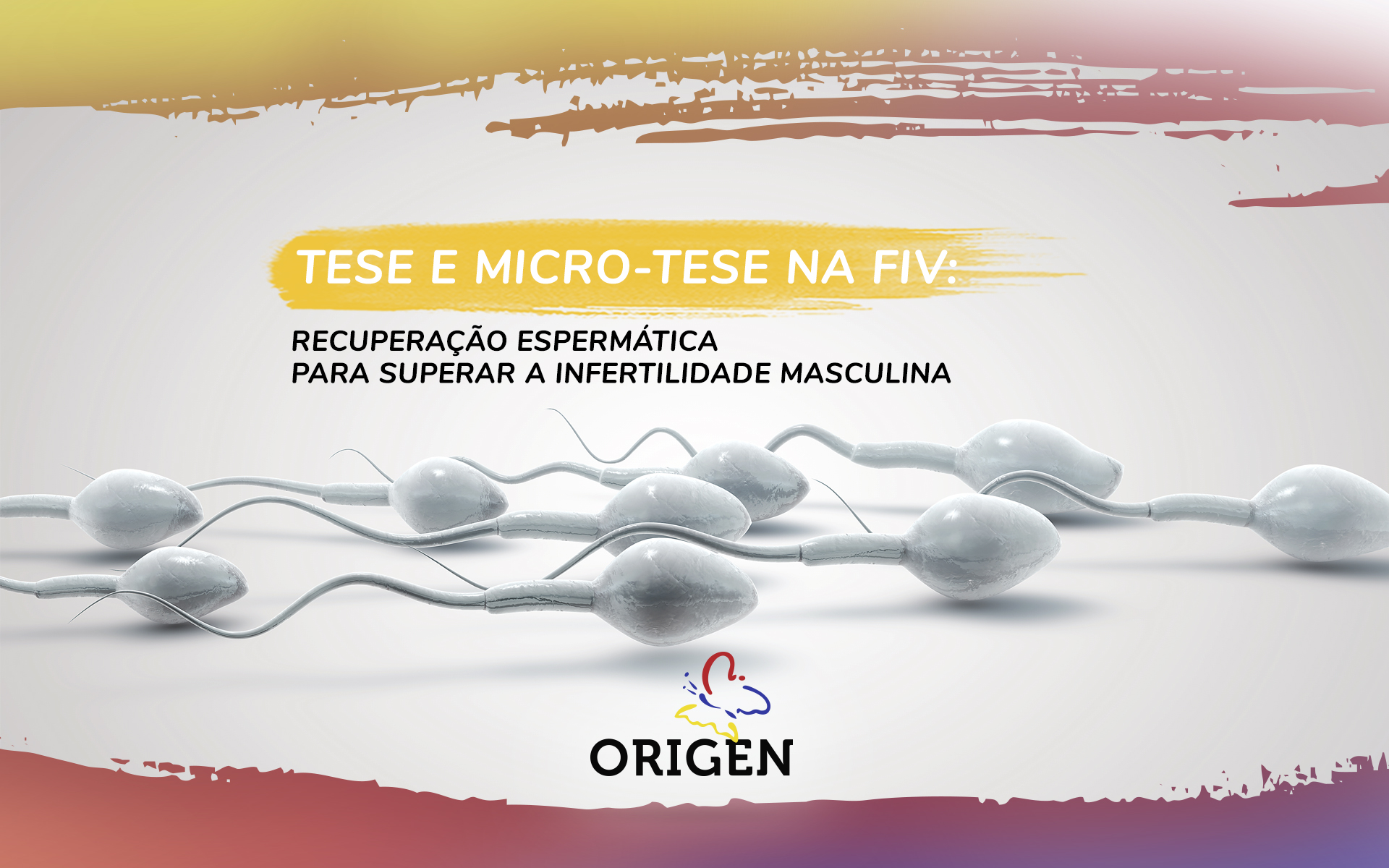 TESE e Micro-TESE na FIV: recuperação espermática para superar a infertilidade masculina