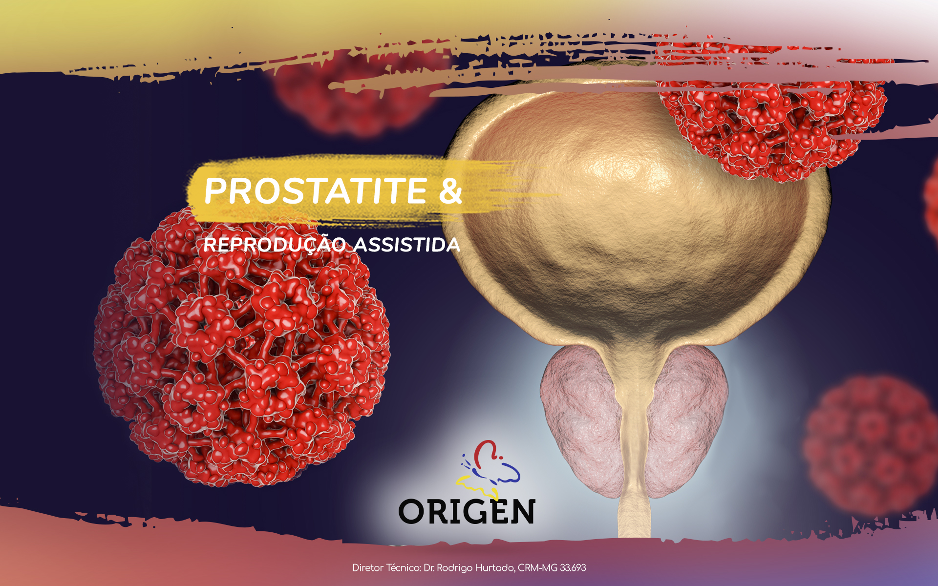 Prostatite e reprodução assistida