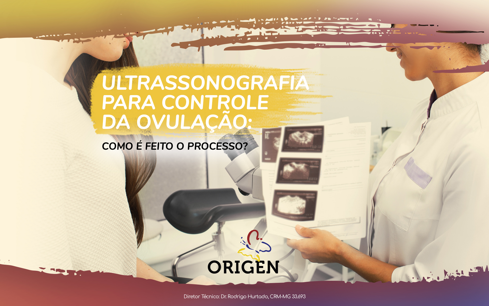 Ultrassonografia para controle da ovulação: como é feito o processo?