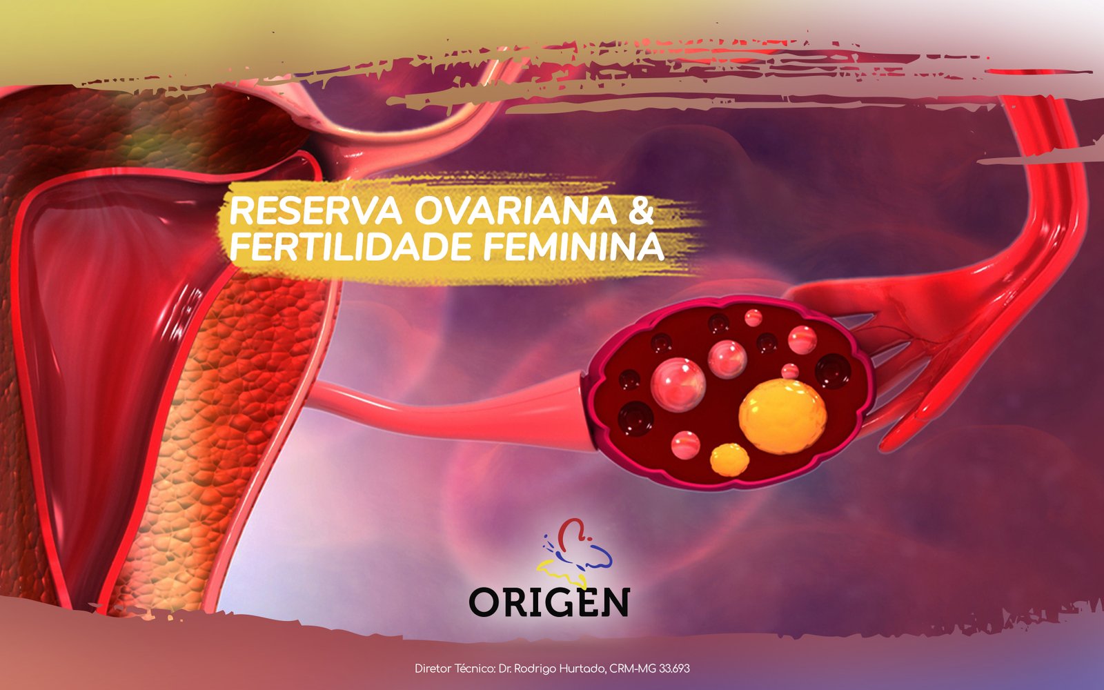 Reserva ovariana e fertilidade feminina Clínica Origen Fertilização in Vitro