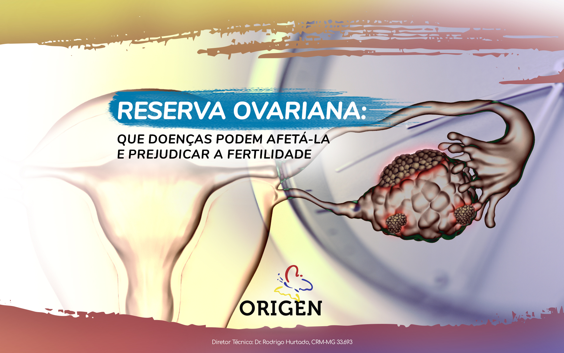 Reserva ovariana: que doenças podem afetá-la e prejudicar a fertilidade
