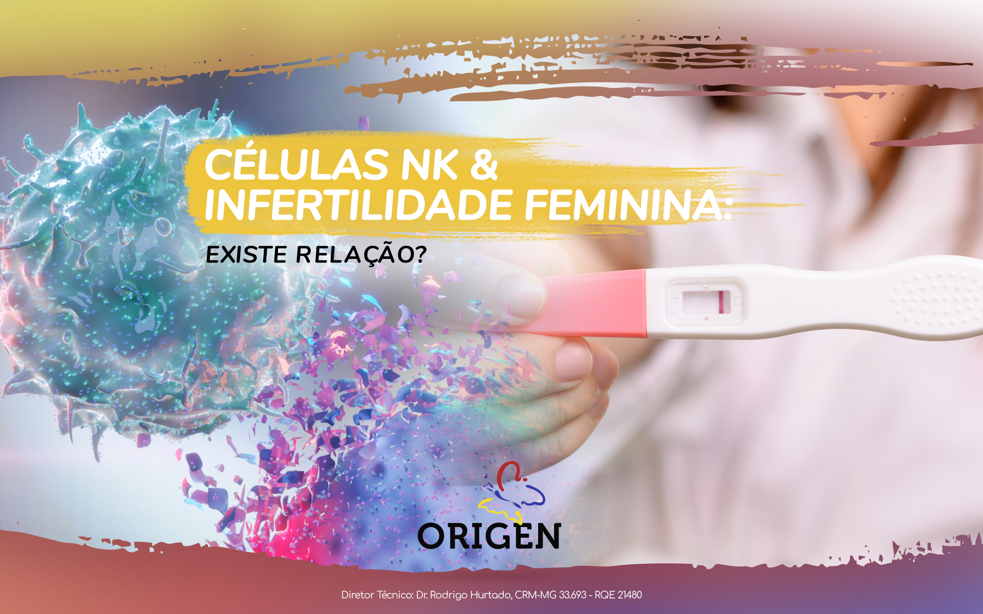 Células NK e infertilidade feminina: existe relação?