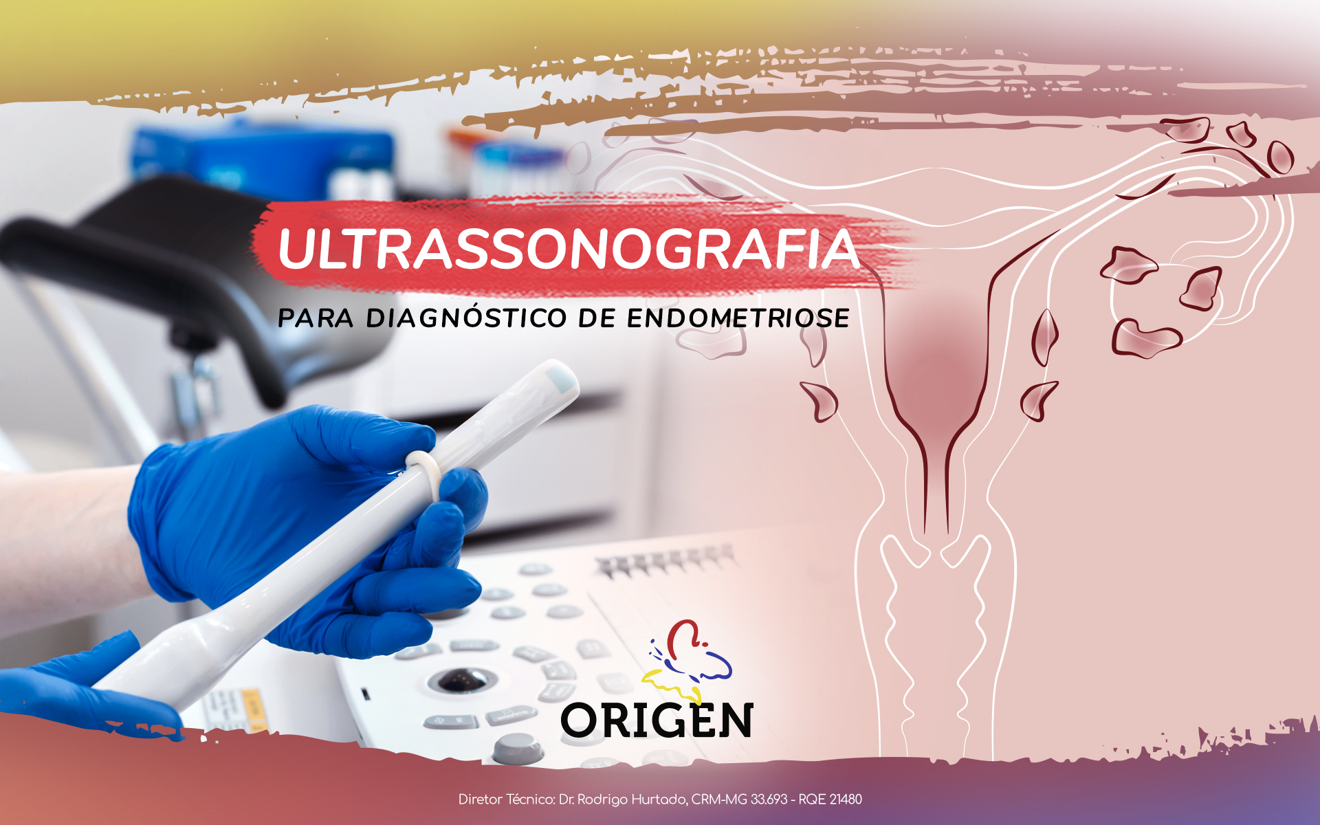 Ultrassonografia para diagnóstico de endometriose