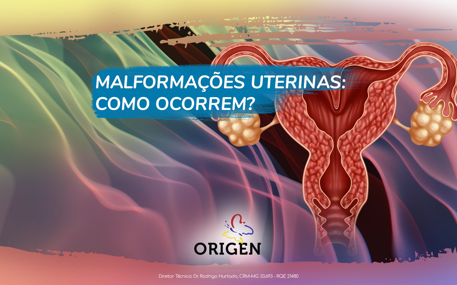 Malformações uterinas: como ocorrem?