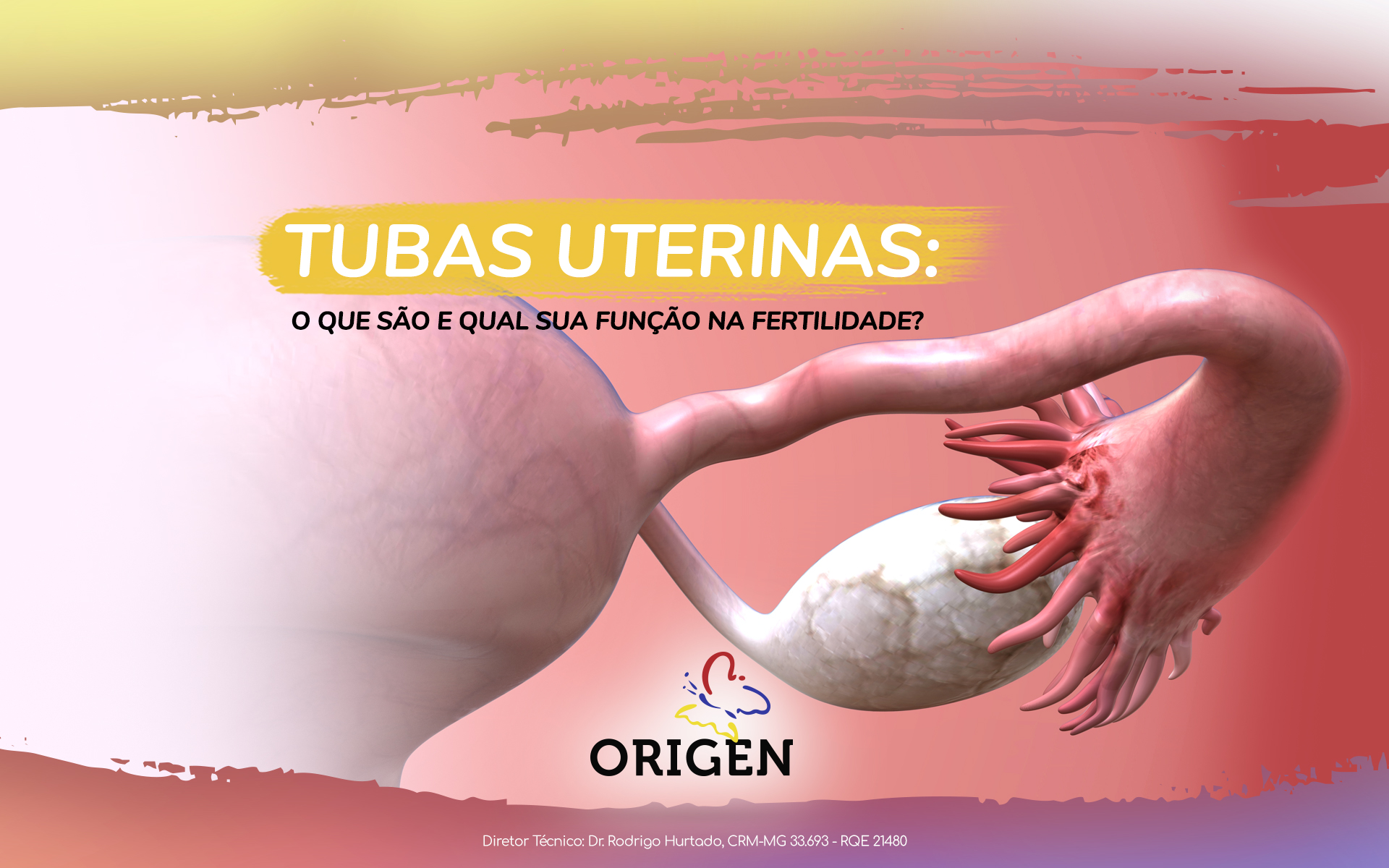 Tubas uterinas: o que são e qual sua função na fertilidade?
