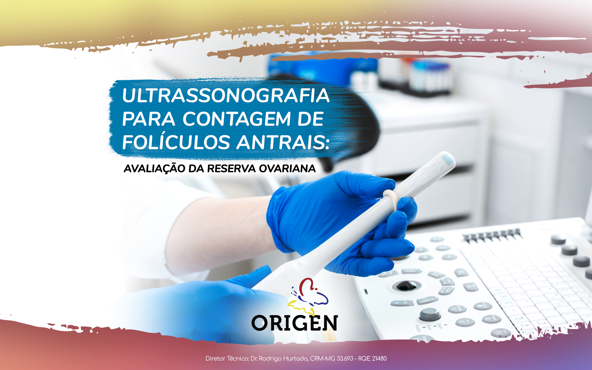 Ultrassonografia para contagem de folículos antrais: avaliação da reserva ovariana