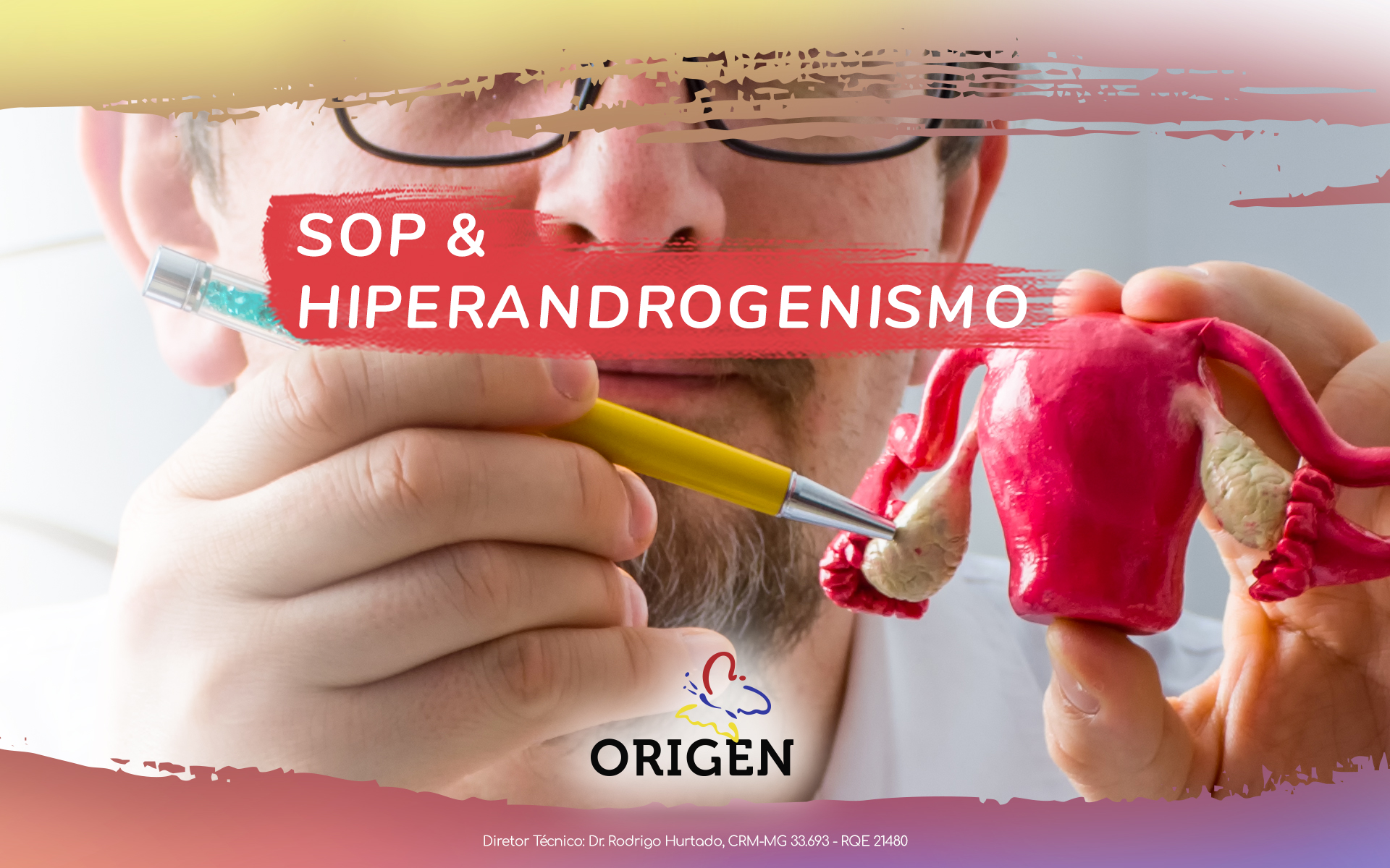 SOP e hiperandrogenismo