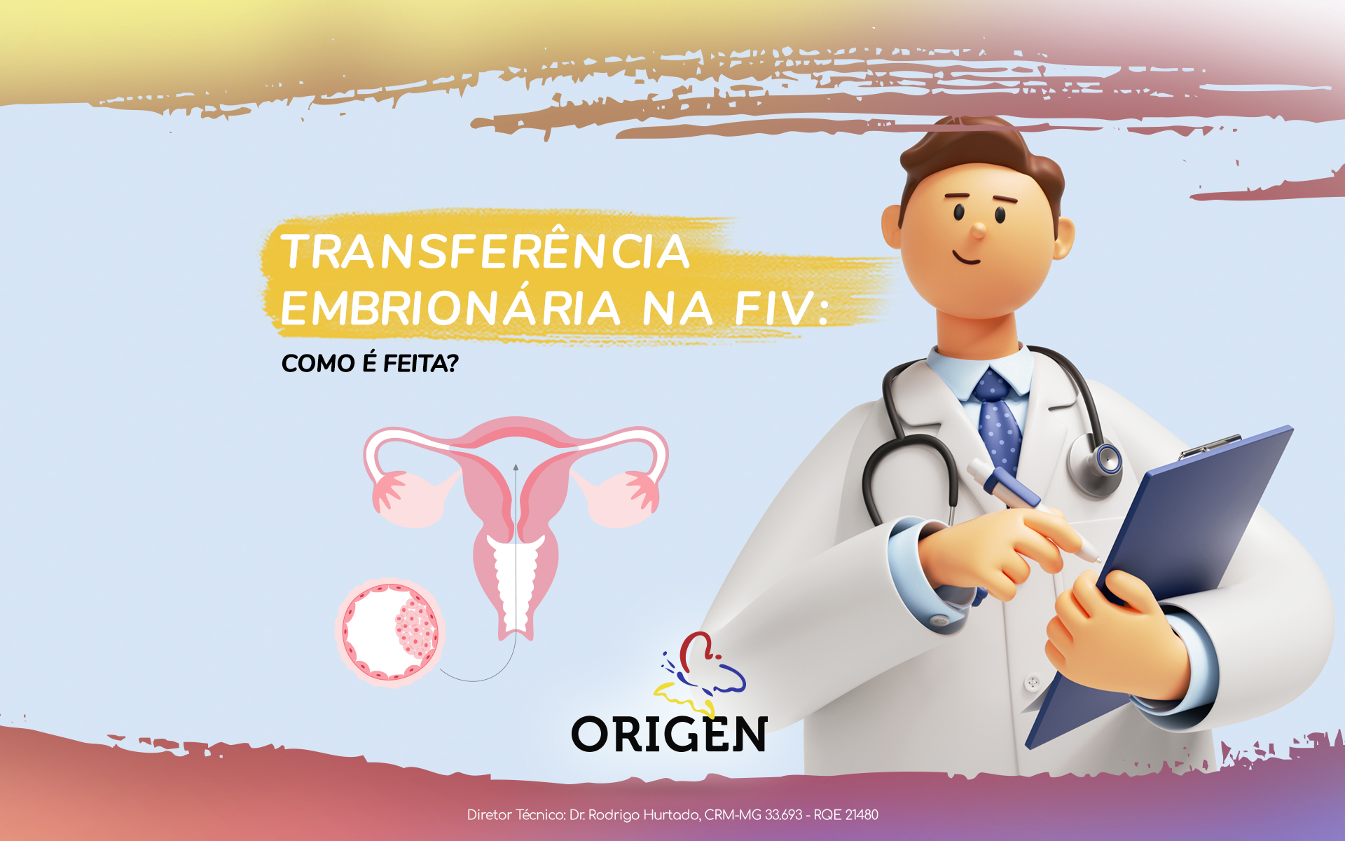 Transferência embrionária na FIV: como é feita?