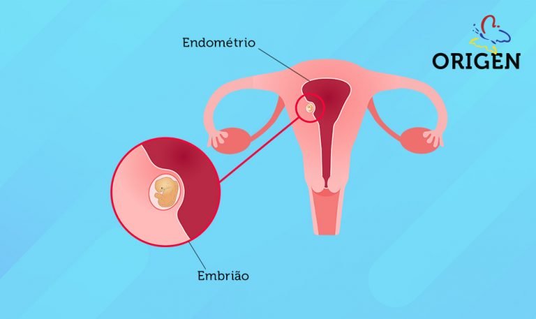 Nidação Na Fiv Saiba Mais Sobre O Assunto Clínica Origen Fertilização In Vitro 