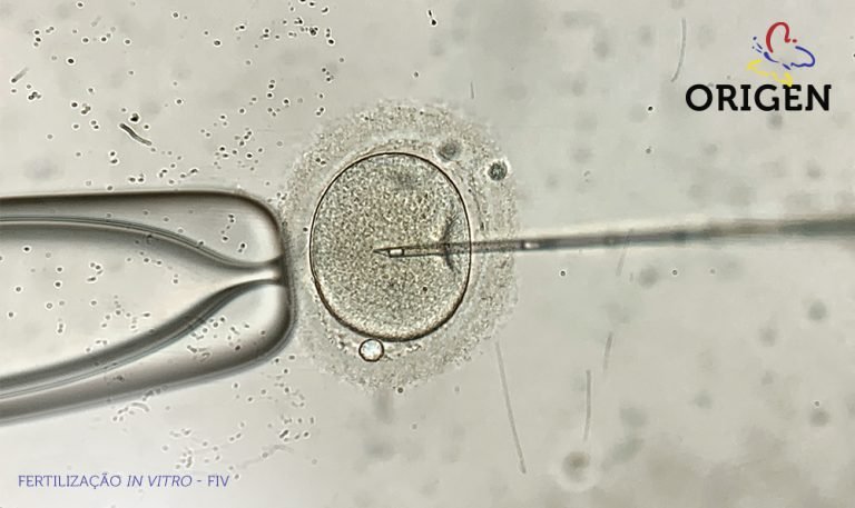 Estimulação Ovariana Conheça Todas As Possibilidades Clínica Origen Fertilização In Vitro 9463