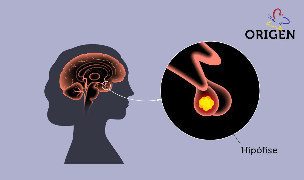 Considerações gerais sobre a hipófise - Distúrbios hormonais e