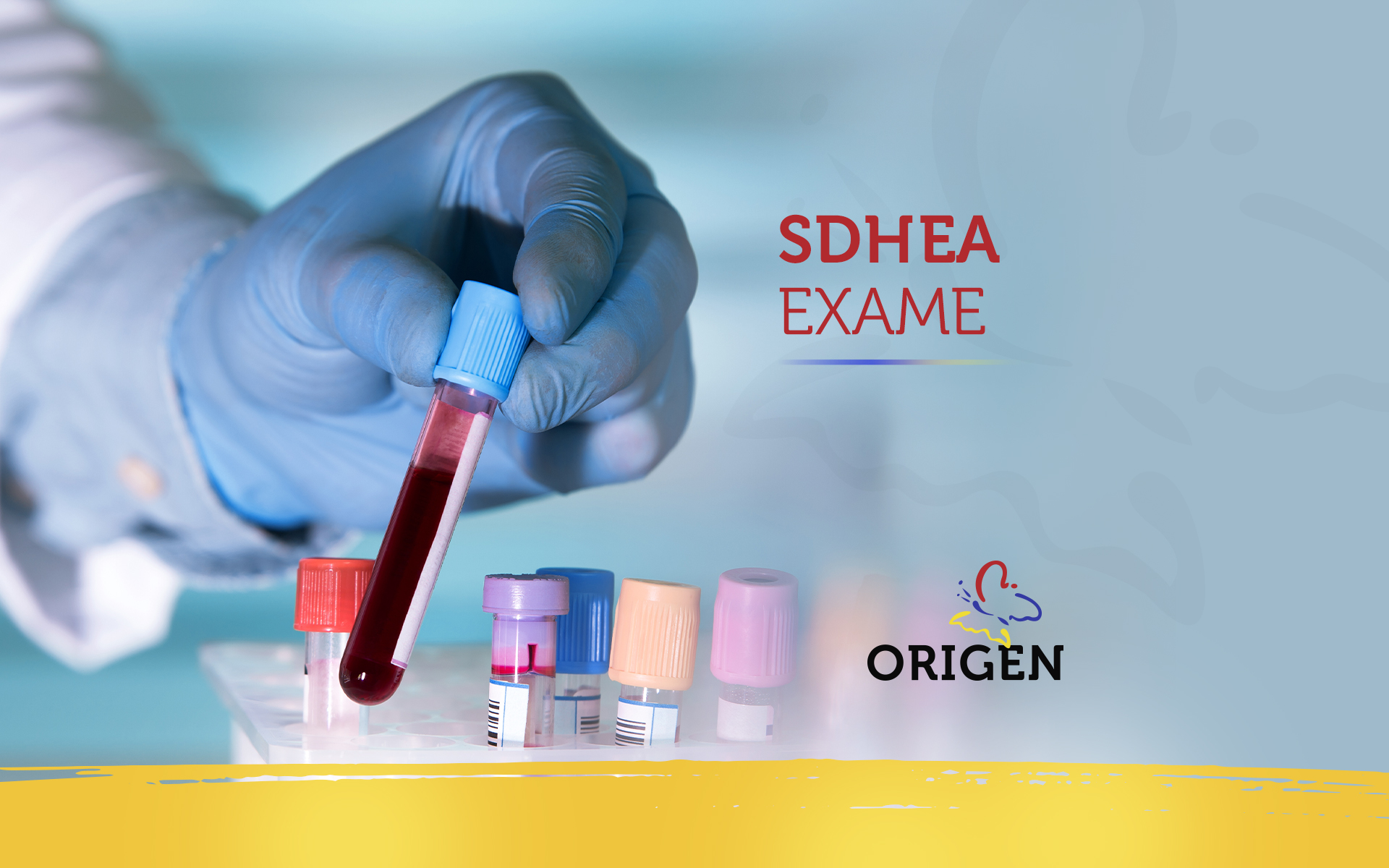 SDHEA exame
