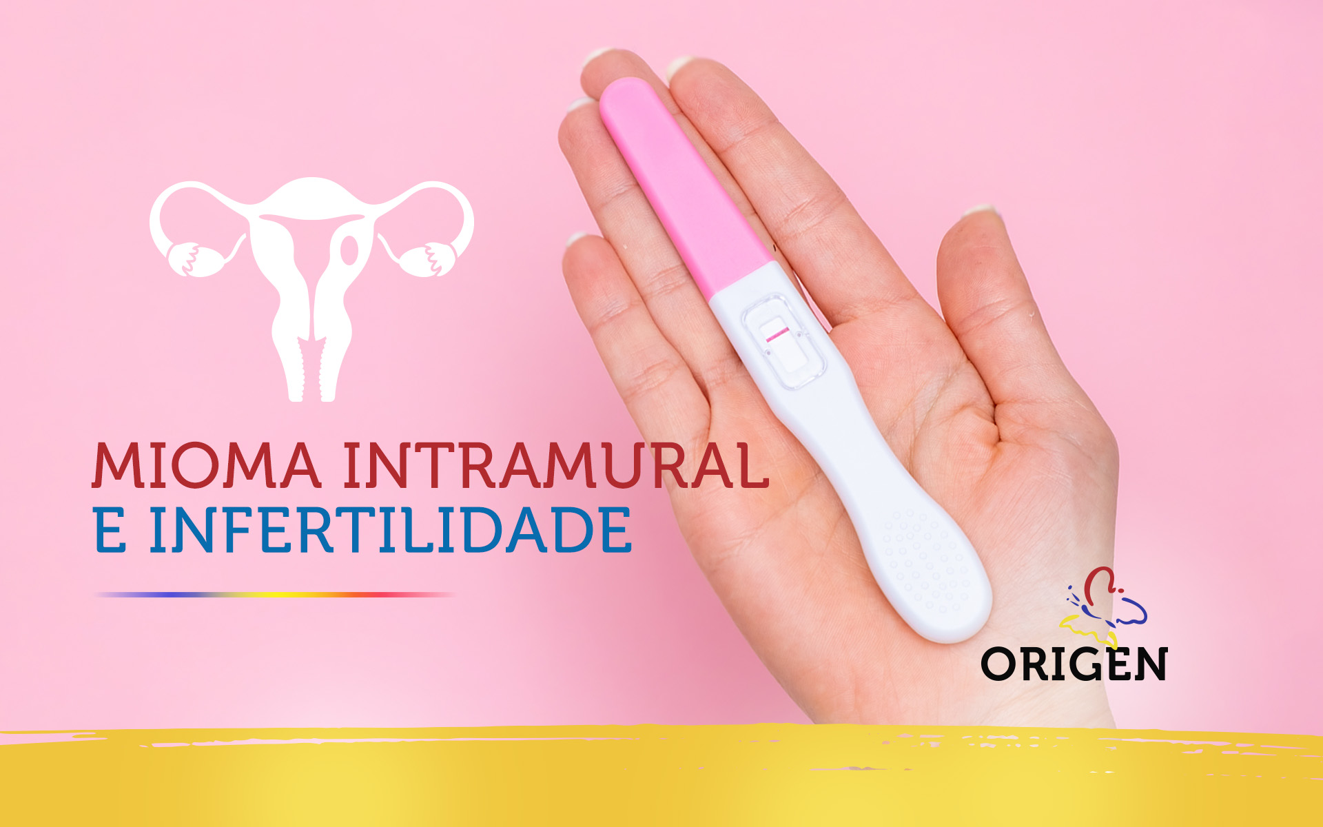 Mioma intramural e infertilidade