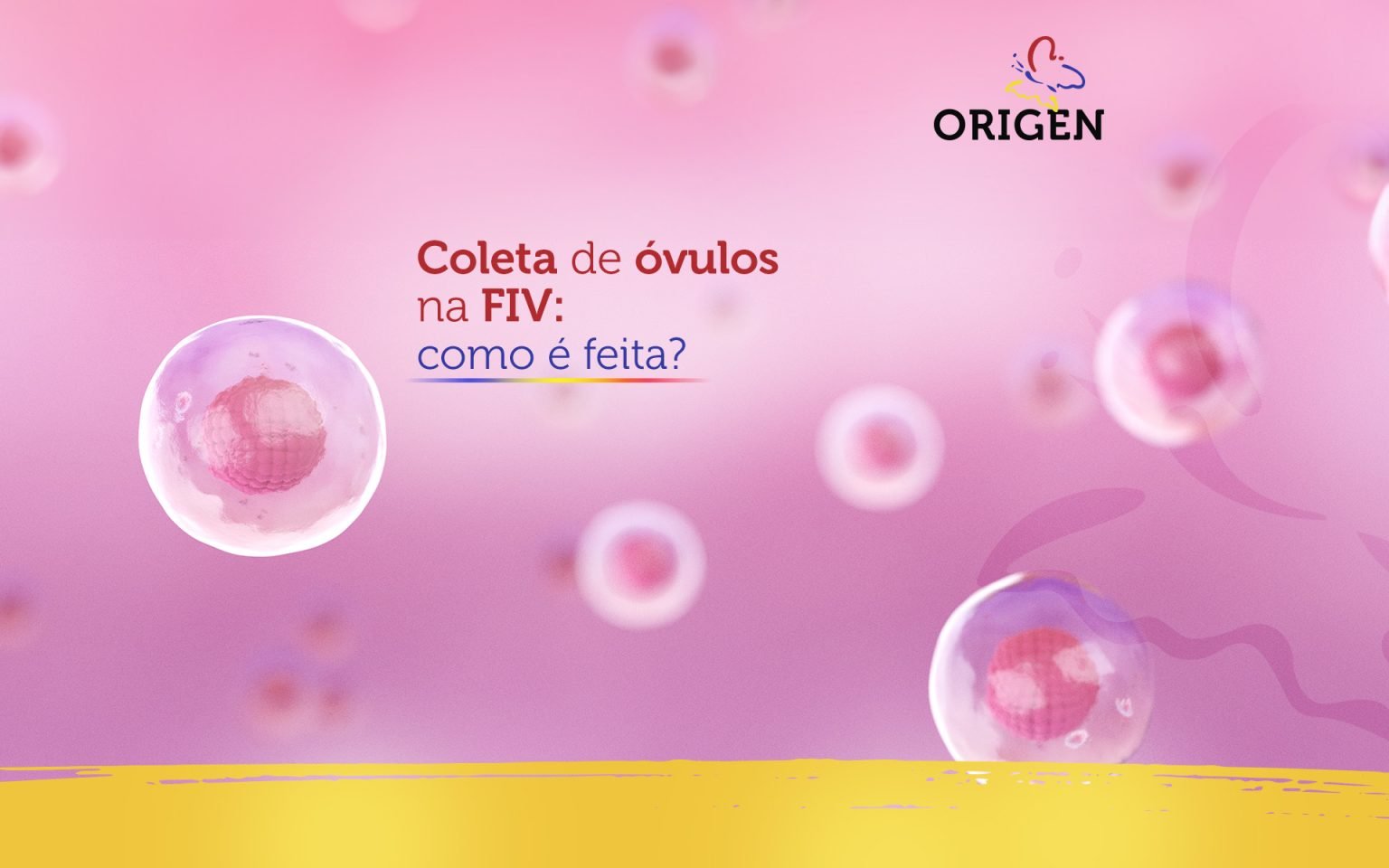 Coleta De óvulos Na Fiv Como é Feita Clínica Origen Fertilização In Vitro