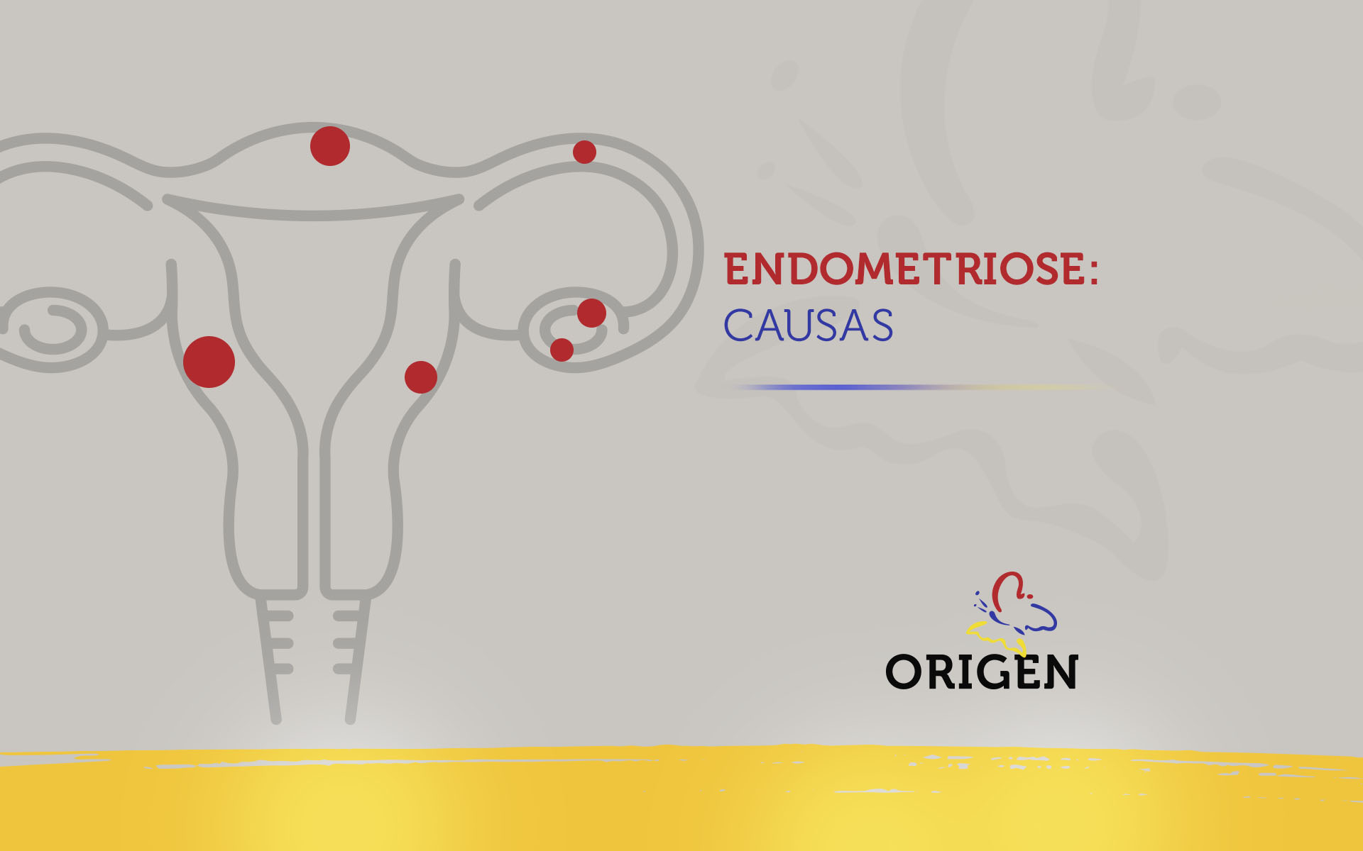 Endometriose: causas