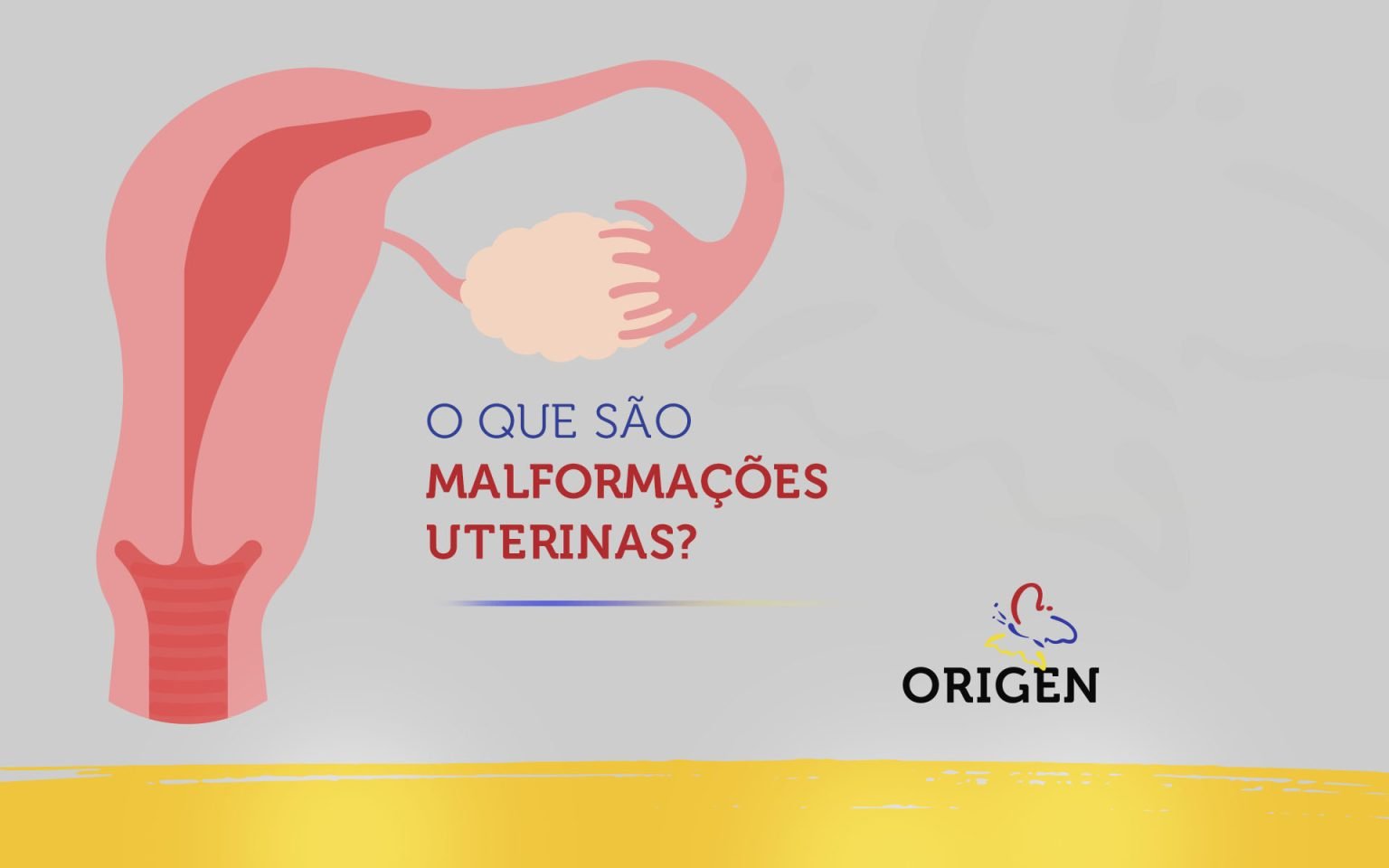 O Que São Malformações Uterinas Clínica Origen Fertilização In Vitro