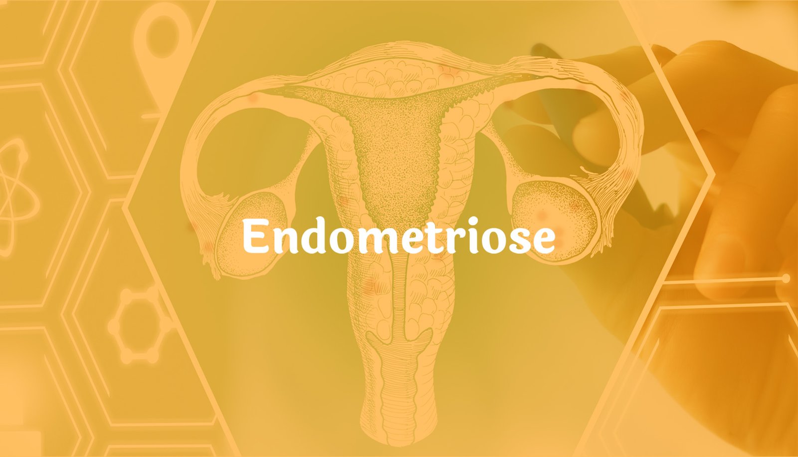 ndometriose-clinica-origen_